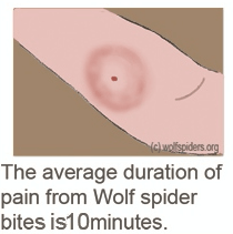 Pain from Wolf spiders bites lasts in average 10 minutes
